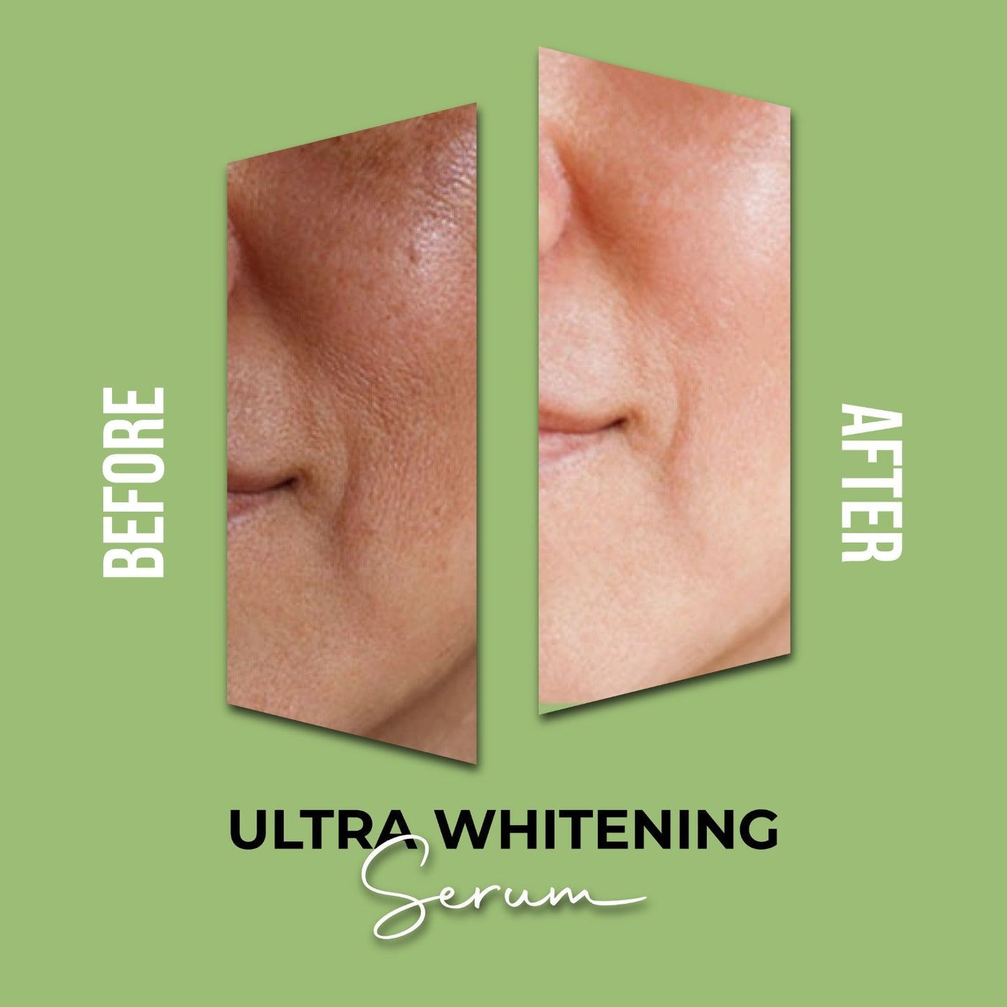 Ultra Whitening Serum (For Dark spots, acne scars, and sun damage)